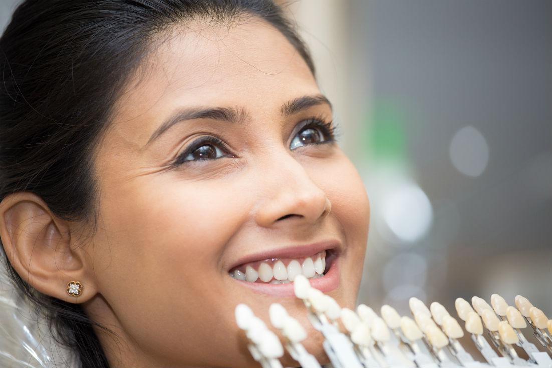 Veneers Burien, WA